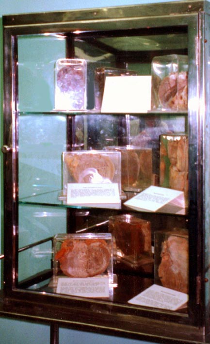 [ Cabinet at Groote Schuur Hospital]